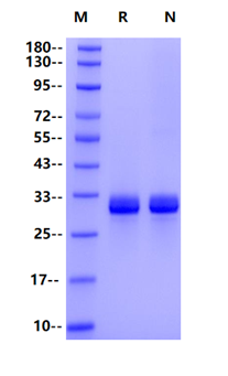 Recombinant Mouse Angiopoietin-1(277-498) Protein(His Tag)产品图
