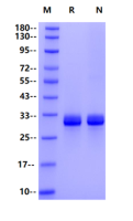 Recombinant Mouse Angiopoietin-1(277-498) Protein(His Tag)