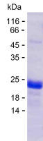Recombinant Human TMEM74 Protein(C-His)