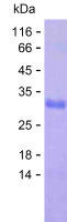 Recombinant Human PRPF40A Protein(C-His)
