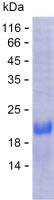 Recombinant Human PRAMEF7 Protein(C-His)