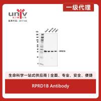 RPRD1B Antibody