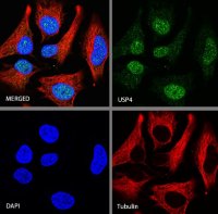 Rabbit anti-USP4 Recombinant Monoclonal Antibody(S-1434-6)