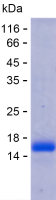 Recombinant Human BBS7 Protein(C-His)