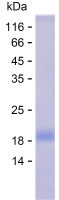 Recombinant Human UNC5B Protein(C-His)