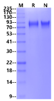 Recombinant Mouse E-Selectin/CD62E His Tag Protein(His Tag)