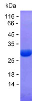 Recombinant Human HIP1R Protein(C-His)