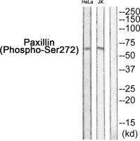 Rabbit anti-Phospho-Paxillin(Ser272) Polyclonal Antibody