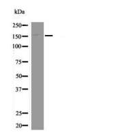 Rabbit anti-Phospho-EPRS (Ser999)Polyclonal Antibody