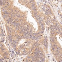 Rabbit anti-RhoA Recombinant Monoclonal Antibody(S-1310-159)