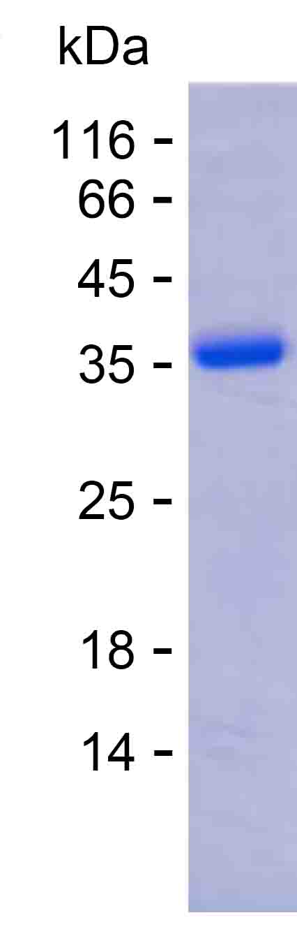 Recombinant Human ADAMTS8 Protein(N-SUMO & C-His)产品图