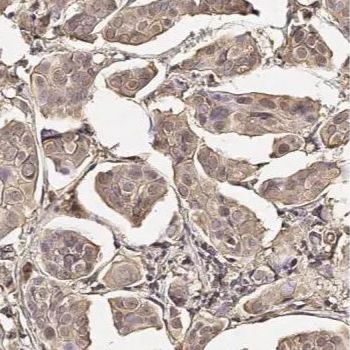 Somatostatin receptor 2 antibody [HL3078]