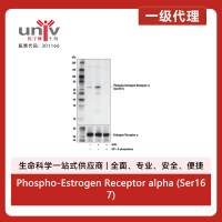Phospho-Estrogen Receptor alpha (Ser167) (D5W3Z) Rabbit Monoclonal Antibody
