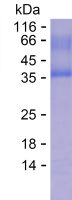 Recombinant Human TMC5 Protein(C-His)