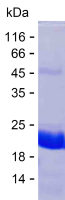 Recombinant Human USP25 Protein(C-His)