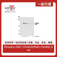 Phospho-PAK1 (Thr423)/PAK2 (Thr402) Antibody