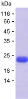 Recombinant Human DMRTA1 Protein(C-His)