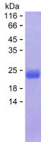 Recombinant Human FAM120A Protein(C-His)
