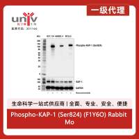 Phospho-KAP-1 (Ser824) (F1Y6O) Rabbit Monoclonal Antibody