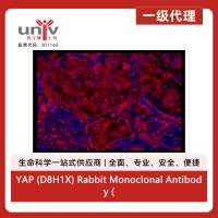 YAP (D8H1X) Rabbit Monoclonal Antibody (Alexa Fluor® 647 Conjugate)