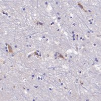 Rabbit anti-PSEN2 Recombinant Monoclonal Antibody(S-2084-14)