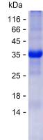 Recombinant Human ATG7 Protein(C-His)