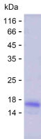 Recombinant Human YK016 Protein(C-His)
