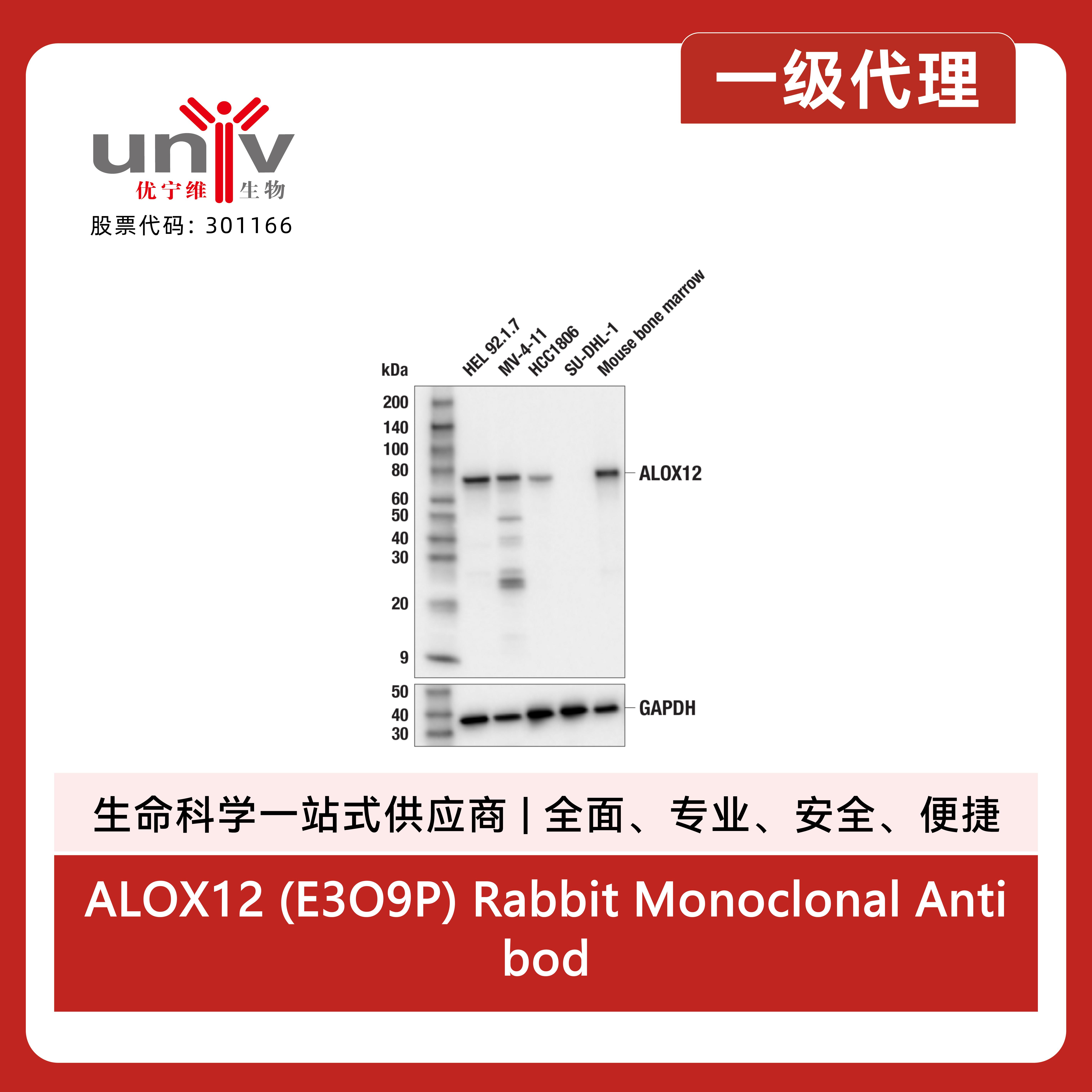 ALOX12 (E3O9P) Rabbit Monoclonal Antibody产品图