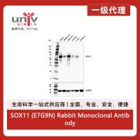 SOX11 (E7G9N) Rabbit Monoclonal Antibody
