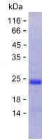 Recombinant Human SYT9 Protein(C-His)