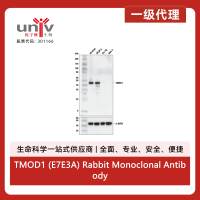 TMOD1 (E7E3A) Rabbit Monoclonal Antibody