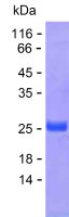 Recombinant Human CALML4 Protein(C-His)