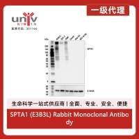 SPTA1 (E3B3L) Rabbit Monoclonal Antibody