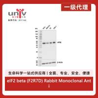 eIF2 beta (F2R7D) Rabbit Monoclonal Antibody