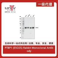 PTBP1 (E5O2S) Rabbit Monoclonal Antibody
