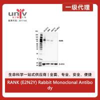 RANK (E2N2Y) Rabbit Monoclonal Antibody