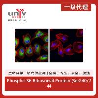 Phospho-S6 Ribosomal Protein (Ser240/244) (D68F8) Rabbit Monoclonal Antibody (Alexa Fluor® 488 Conjugate)
