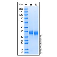 Recombinant Human Azurocidin/CAP37/HBP Protein,无动物源,无载体,生物活性,ActiBioPure™,高性能,His标签,≥95%(SDS-PAGE),阿拉丁