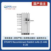 STEAP3 Recombinant Rabbit mAb (S-4466-26)