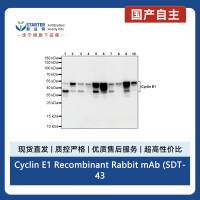 Cyclin E1 Recombinant Rabbit mAb (SDT-4375-29)