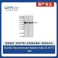 ALDH2 Recombinant Rabbit mAb (S-4173-20)