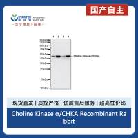 Choline Kinase α/CHKA Recombinant Rabbit mAb (S-4422-31)