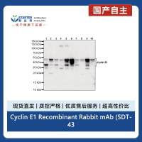 Cyclin E1 Recombinant Rabbit mAb (SDT-4375-44)