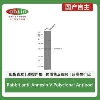 Rabbit anti-Annexin V Polyclonal Antibody