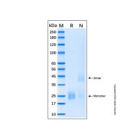 Recombinant Human IL-17E Protein，无动物源,无载体,His标签,≥90%(SDS-PAGE),See COA，阿拉丁