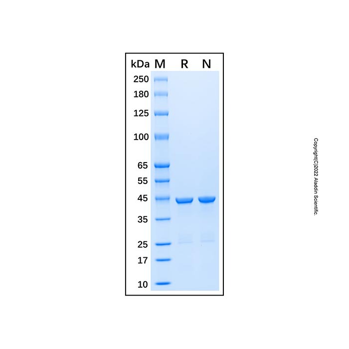 Recombinant Human Cytokeratin 19 Protein，无载体,His标签,≥95%(SDS-PAGE)，阿拉丁