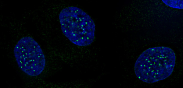 图 5：CENP-A phospho Ser18 抗体（Cat #61483）的免疫荧光染色结果