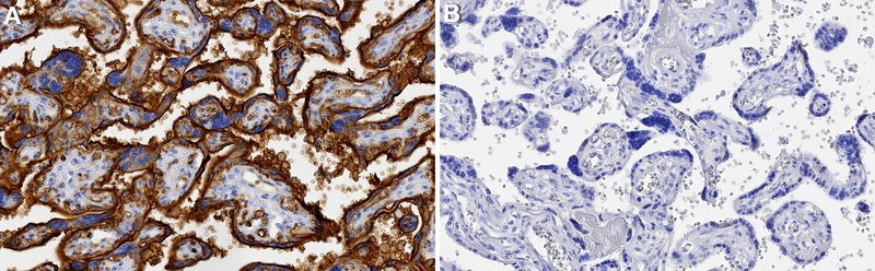 抗-GLUT-1抗体,CT from rabbit, purified by affinity chromatography