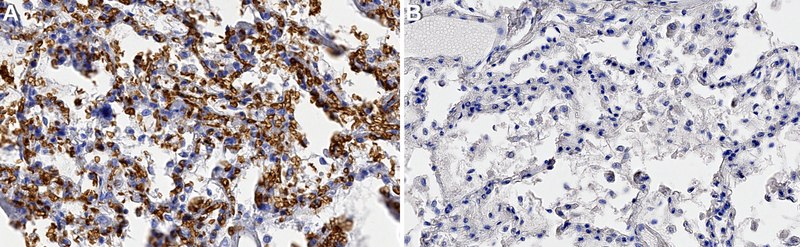 抗-GLUT-1抗体,CT from rabbit, purified by affinity chromatography