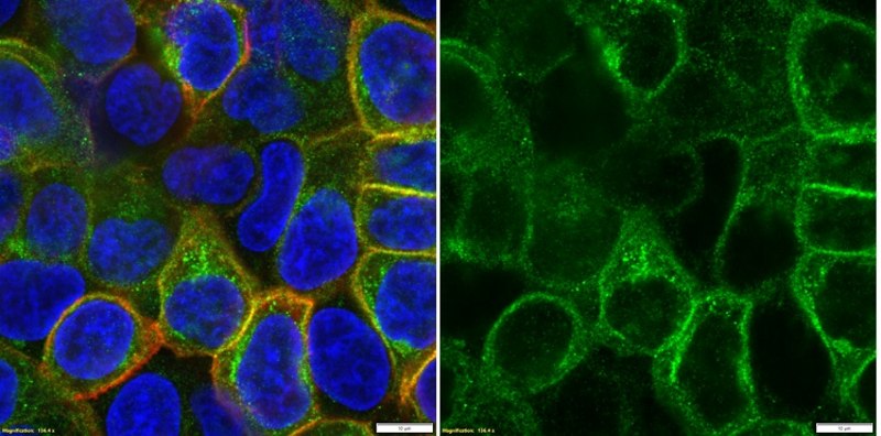 抗-GLUT-1抗体,CT from rabbit, purified by affinity chromatography